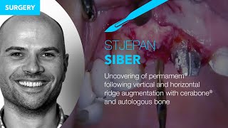 Uncovering of permamem® following ridge augmentation with cerabone® and autologous bone