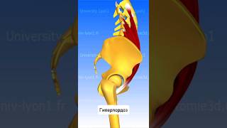 Причина гипер ЛОРДОЗА поясницы ● Пояснично-подвздошная мышца