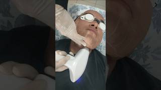 18° Seção de Depilação com Laser na Dermepil