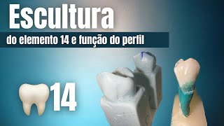 Escultura do dente 14